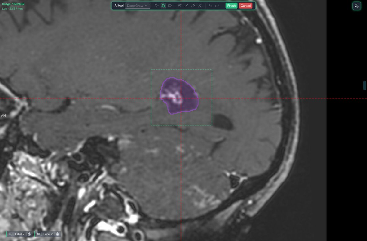VinLab_io's tweet photo. 💐VinLab FREE version are available!🎉
https://t.co/y8nM9XgPIQ
This annotation tool of medical images is not only have some of the most advanced annotation tools like AI-assisted segmentation, multi-plane annotation, or polygon sculpting, but also support external storage https://t.co/K7zrbaGYdM