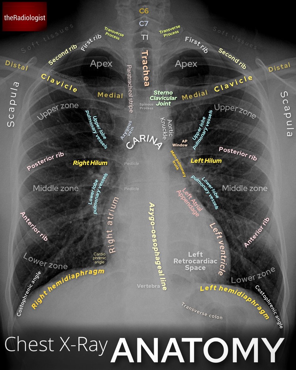 BrownJHM's tweet photo. Chest Xray anatomy and review areas @radiologistpage #FOAMed https://t.co/EyG487mb6s