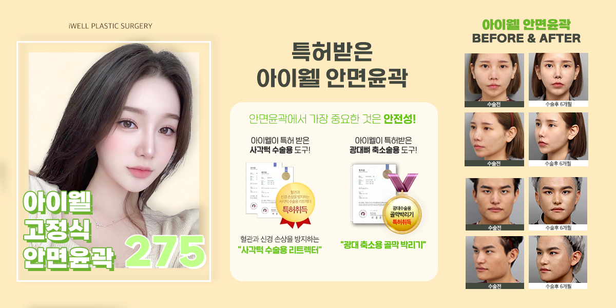 iwellps's tweet photo. 💗아이웰 안면윤곽 이벤트💗

#아이웰성형외과 #안면윤곽 !
실력으로 증명하는 아이웰성형외과😍
#고정까지 확실하게!
아이웰 고정식 안면윤곽
275 이벤트 진행중❤

📞 상담문의: 02-542-2017
💛 카톡상담: @아이웰성형외과
💌 인스타 DM문의: @iwellps
👣오시는 길👣 : 압구정역 4번출구 도보 50m https://t.co/7ZvCcULXjH