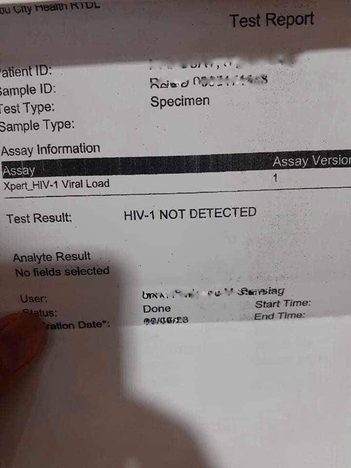 JohnPOZ3's tweet photo. Still undetectable as of January. Laban lang ta dapat and maintain lang. ❤️❤️❤️

#PLHIV #PLHIVdiaries #poz https://t.co/itqQP0UiXn