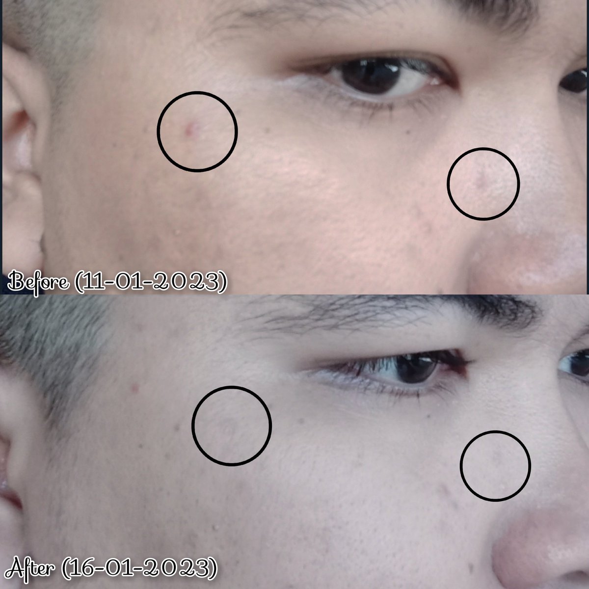 muslimdrmwn's tweet photo. Retinol 🤝 Niacinamide
Perpaduan sempurna untuk kulit yang rentan berjerawat sekaligus investasi anti penuaan dini👌

Kali ini aku mau rekomendasiian serum terbaru dengan perpaduan 3x Retinol + 
Niacinamide, resultsnya juga muantep poll😍
#RacuninSkincare #DarmaReview https://t.co/bh23z5Pg2z
