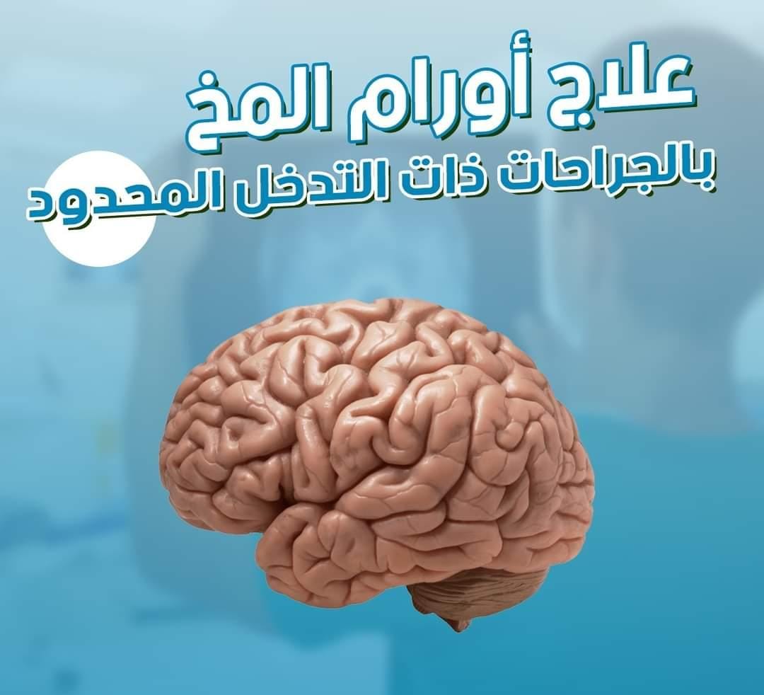 IPS_TEAM's tweet photo. علاج أورام المخ بالجراحات ذات التدخل المحدود في الهند
للاستفسار ارجو المراسلة بالخاص https://t.co/wEy2g7MZ6x