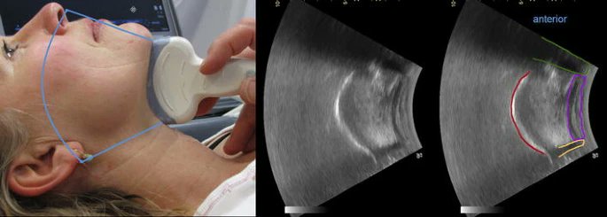 NephroPOCUS tweet media