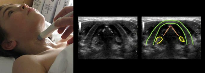 NephroPOCUS tweet media