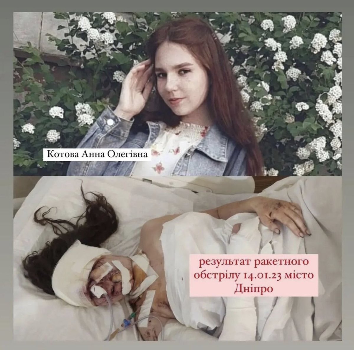 maksymeristavi's tweet photo. this is hanna kotova. she escaped genocide in sievierodonetsk last year. the day before russia hit her new home in dnipro with anti-warship missile she celebrated her 19th birthday. now she is fighting for her life in icu.

russia is a death cult https://t.co/JVDukVDDPP