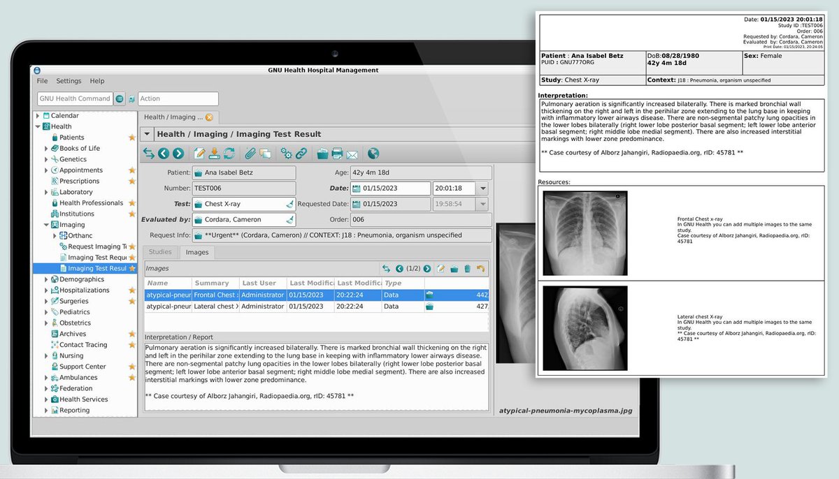 gnuhealth's tweet photo. #GNUHealth Dx Imaging reporting in upcoming 4.2 . Very are also very happy to work along the #Orthanc community to deliver the best RIS solution 😎 #MedicalImaging  #OpenScience #SocialMedicine #GNU  #LibreSoftware https://t.co/vcATwpbqVx