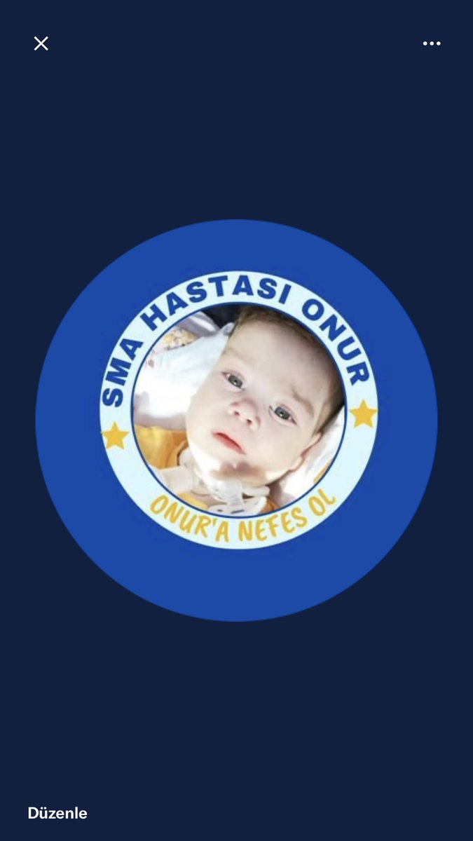 Göktuğ’um kazandı Artık Onur Bebeğim için savaşacağız.
Durumu çok kötü 😭
Ve Boncuk gözlümün bugün doğum günü o ise hastanede yaşam savaşı veriyor.
1 yaşında ama 4 kiloya kadar zayıfladı 🥺🥺🥺kampanyası 11 ayda %10 ne olur tutalım elinden. Arkanızı dönüp gitmeyin