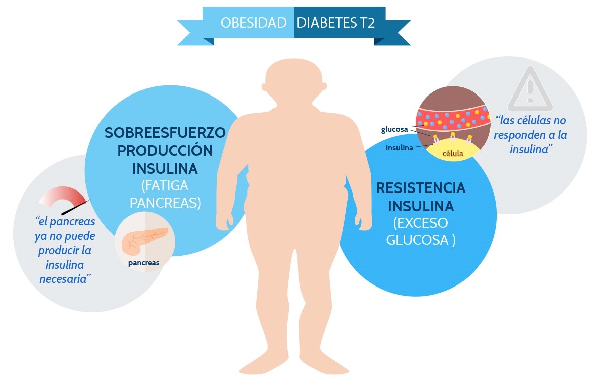 Cuanto tarda entrar en cetosis obesidad tipo 2