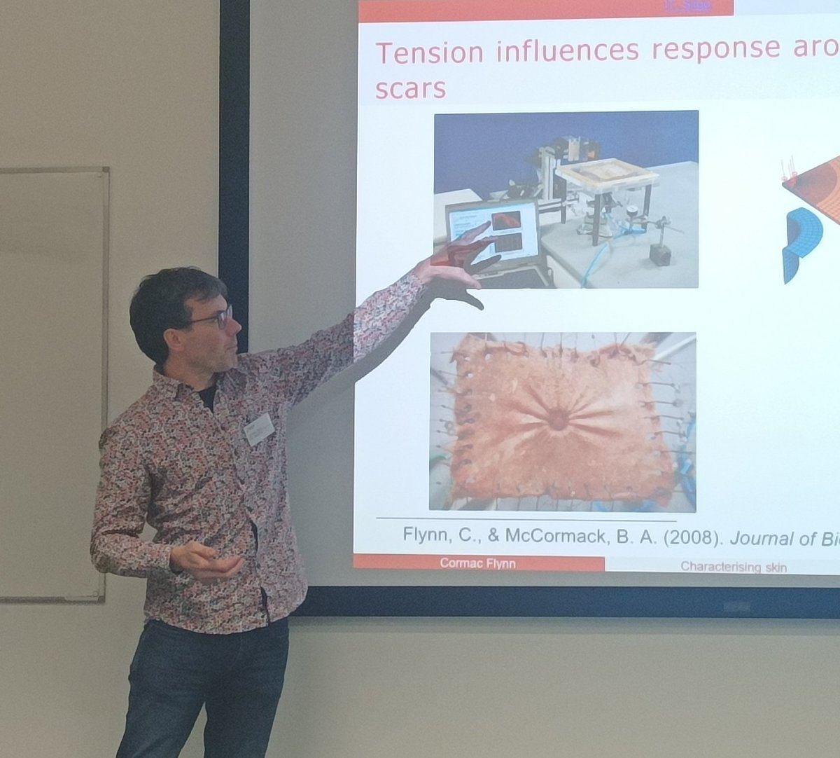 MOCHAS_PRTP's tweet image. Dr. Cormac Flynn @FlinnerC  &apos;The skinny on the integumentary system&apos; @atu_ie&apos;s Symposium on Modelling &amp;amp; Computation for Health &amp;amp; Society. Outlining how Mathematical techniques can be applied to calculate Skin Tension. @ATU_GalwayCity @atusligo_ie @ATUDonegal_ #MOCHAS_PRTP