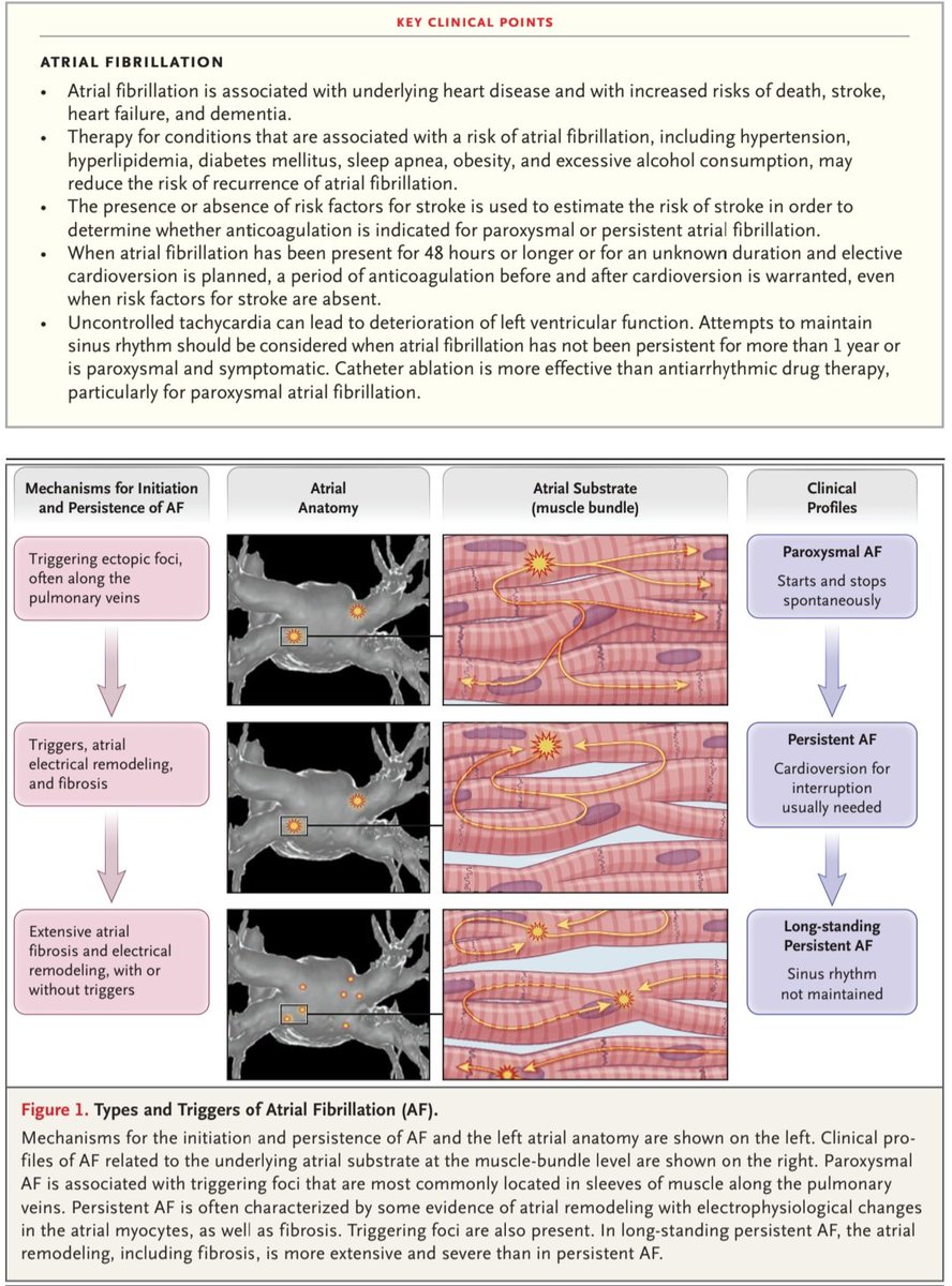 javier20ch's tweet photo. Fibrilación auricular🫀💥
✨️Revisión práctica por @NEJM 💯
▪️>2/3 de los 👥️ con FA de novo tienen patrón paroxístico, del 5-10%/año tienen progresión a persistente✍️
▪️Dx: taquiarritmia irregular (R-R variable).
▪️Tto: control FC/ritmo, anticoagulación
https://t.co/V0VStOHlOM https://t.co/iKXDM6yEU1