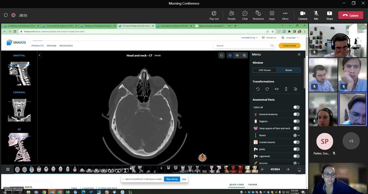 Sarah Kilic, MD (@sarahkilicmd) on Twitter photo Huge thank you to <a href="/CleClinicMD/">Cleveland Clinic MD</a> #radonc alum <a href="/JBroughmanMD/">Jimmy Broughman</a> for a masterful skull base anatomy lecture this morning! Looking forward to lectures from other alumni in our Alumni Speaker Series later this year! <a href="/ShlomoKoyfmanMD/">Shlomo Koyfman</a> isn't gonna know what hit him at NPX conf this week... Huge thank you to <a href="/CleClinicMD/">Cleveland Clinic MD</a> #radonc alum <a href="/JBroughmanMD/">Jimmy Broughman</a> for a masterful skull base anatomy lecture this morning! Looking forward to lectures from other alumni in our Alumni Speaker Series later this year! <a href="/ShlomoKoyfmanMD/">Shlomo Koyfman</a> isn't gonna know what hit him at NPX conf this week...