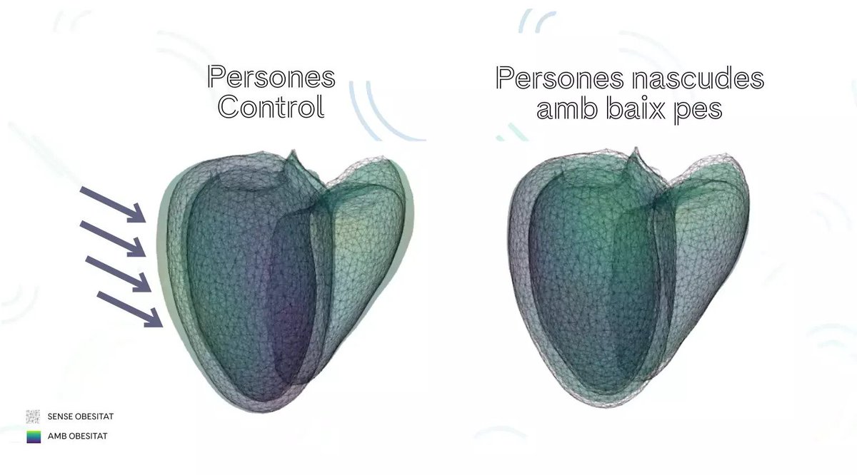 🫀 L’obesitat potencia el risc cardiovascular en persones nascudes amb baix pes.

🧪 Un estudi liderat pel #CLÍNIC-<a href="/idibaps/">IDIBAPS</a> demostra que aquest fet limita la capacitat del cor d’adaptar-se quan hi ha un altre factor de risc com l’obesitat.

➕ Info 👉 bit.ly/3GKYBYr