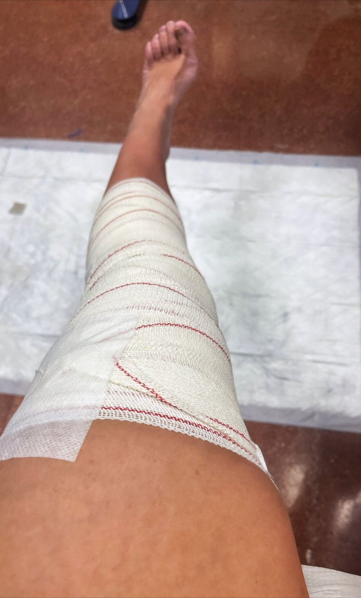 katiamartin86's tweet photo. Mi paciencia ya se acabó. Aguanté bastante, 10 meses en el dique seco. Aunque al principio cueste un poco. #lesiónderodilla #workoutdone #gymtime #4grados https://t.co/h34M41yX4k