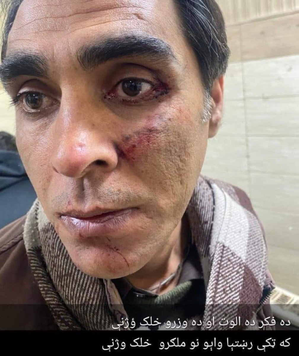 cheegha's tweet photo. 1/4Our teacher, comrade and a very sweet friend Sir Akhtar Khan has been brutally tortured by few unknowns in Mardan. He’s a teacher in AWKUM and a very progressive person. I don’t know why this state still remains a dangerous place for activist, journalists and all those who, https://t.co/LHzwJmT0XM