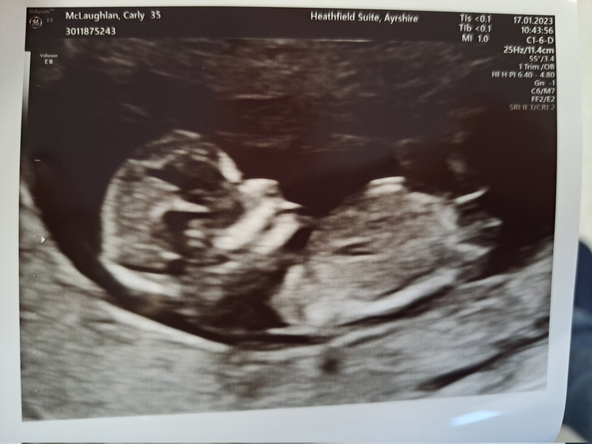 David Feeney tweet media