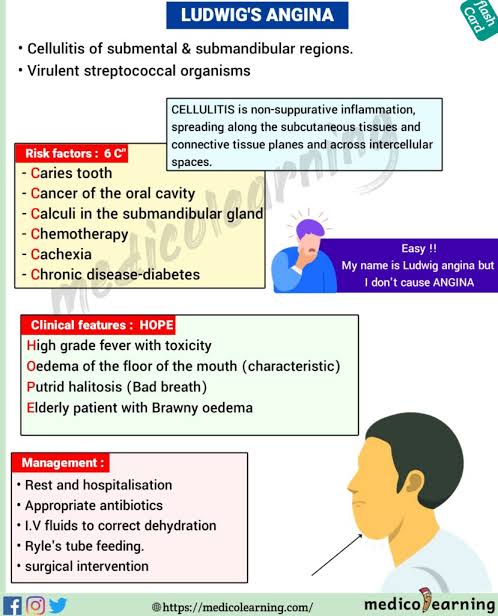 medicalinfo0's tweet photo. @ManualOMedicine Ludwig's angina
By https://t.co/7lx13O6ZkY https://t.co/0AC5umPqNl