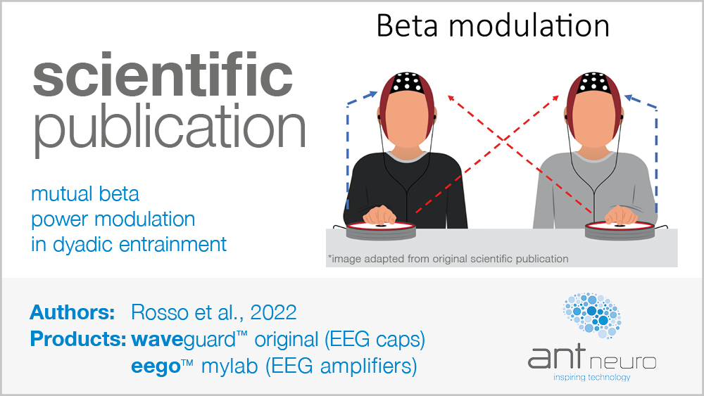 ANTNeuro's tweet image. This #hyperscanning study provides evidence to suggest that periodic beta power modulations are a critical mechanism underlying interpersonal #synchronization. The findings uncovered brain dynamics of interest in a narrow beta range centered at 20 Hz: ow.ly/OFor50MsOGA