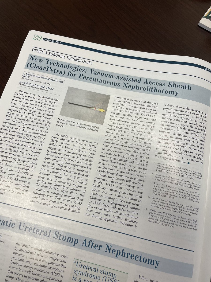 We love to see it in print! New AUA News article out from our own <a href="/SMMohagheghP/">Mohammad Mohaghegh, MD, FRCSC</a> and <a href="/BodoKnudsen/">Bodo Knudsen</a> on Vacuum-assisted Sheath Access for PCNL 👏 <a href="/AmerUrological/">Amer. Urol. Assn.</a> <a href="/OSUWexMed/">The Ohio State University Wexner Medical Center</a> #OSUWexMed #AUANews #UrologyRocks
