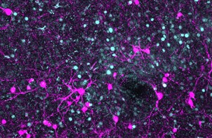 How memories form across the #brain. Understanding how #neurons coordinate to create memories could one day point to interventions for disorders. In PNAS Journal Club: ow.ly/H17j50MsOVT #neurobiology #engram #MemoryEnsemble #amygdala #microscopy