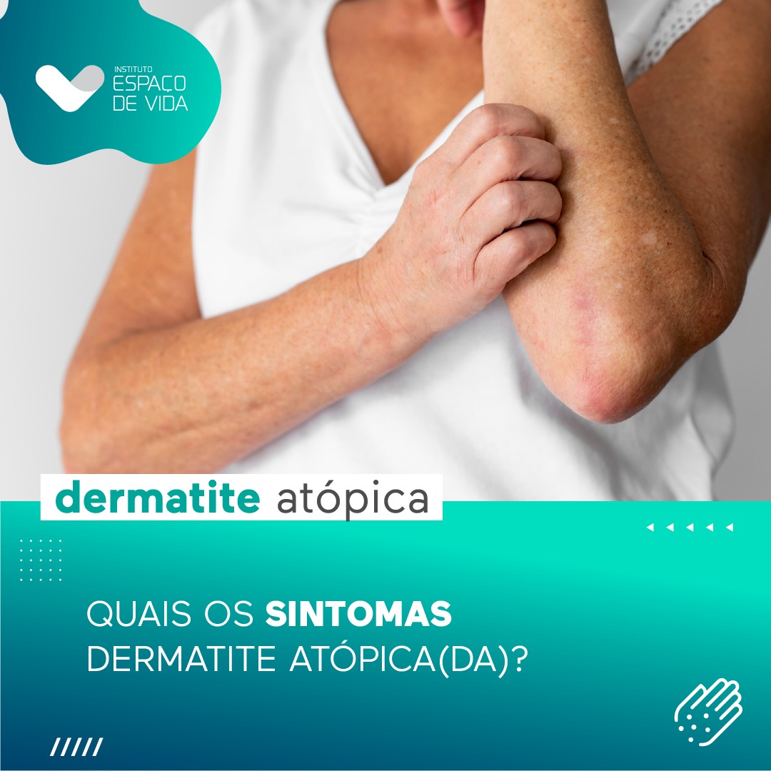 iEspacodeVida's tweet photo. A coceira é a marca registrada da DA, com alguns dados mostrando que mais de 85% das pessoas com a condição experimentam esse sintoma angustiante todos os dias.

Conheça tudo sobre Dermatite Atópica em nosso site: 
https://t.co/fiDJoQNSro

#DermatiteAtopica #Sintomas https://t.co/4UaQP0wSVE