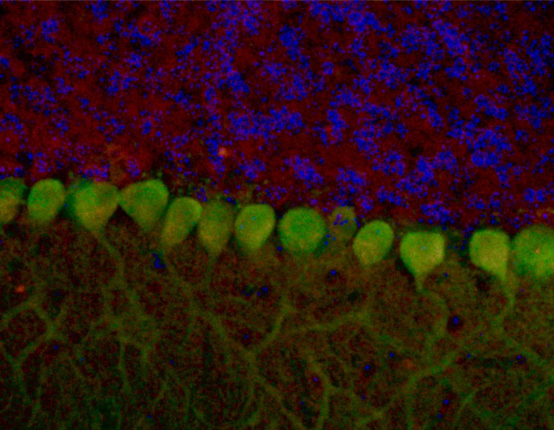 Tal Benjamin Zukerman (@talbenzuk) on Twitter photo Some of the largest neurons in the brain - #purkinje cells. Mouse cerebellum stained for Calbindin (green), PRKAR1B (red) and hoechst (blue). <a href="/RIlouz/">Ronit Ilouz</a> lab. #microscopy #immunofluorescence #cerebellum #brain #immunostaining #bioart #sciencemeetart #STED Some of the largest neurons in the brain - #purkinje cells. Mouse cerebellum stained for Calbindin (green), PRKAR1B (red) and hoechst (blue). <a href="/RIlouz/">Ronit Ilouz</a> lab. #microscopy #immunofluorescence #cerebellum #brain #immunostaining #bioart #sciencemeetart #STED