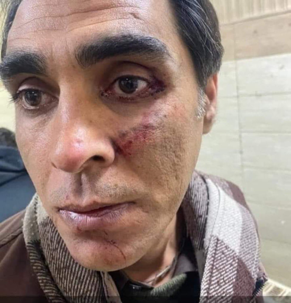 KalamWazir's tweet photo. Today in Abdul Wali Khan University political science professor Akhtar Khan Wazir was tortured by armed goons in Mardan, which is a worrying act.  Pashtunkhawa Milli Awami Party condemns this cowardly act &amp; demands that the perpetrators be brought to justice as soon as possible. https://t.co/j8kh2XxarM
