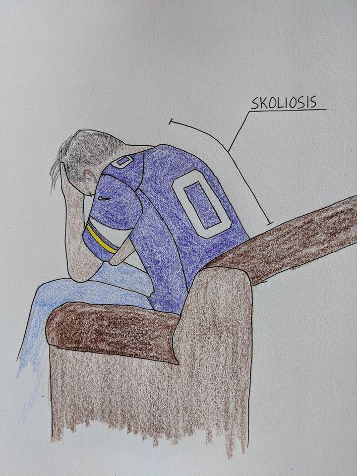 Vikeologist's tweet photo. I'm definitely suffering from SKOLiosis https://t.co/0pGgJMrGtf