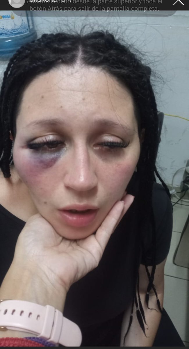 desaparecidaorg's tweet image. #URGENTE RECIBIMOS DENUNCIA #MARDELPLATA  Ornella Capuni tiene 20 años, pide ayuda!, fue golpeada y abusada por el tatuador Ian Lionel Acosta. 
En este breve hilo va toda la información y fotos recibidas, que publicamos para que se haga #justicia. 

Fuente; ig de la víctima&amp;gt;