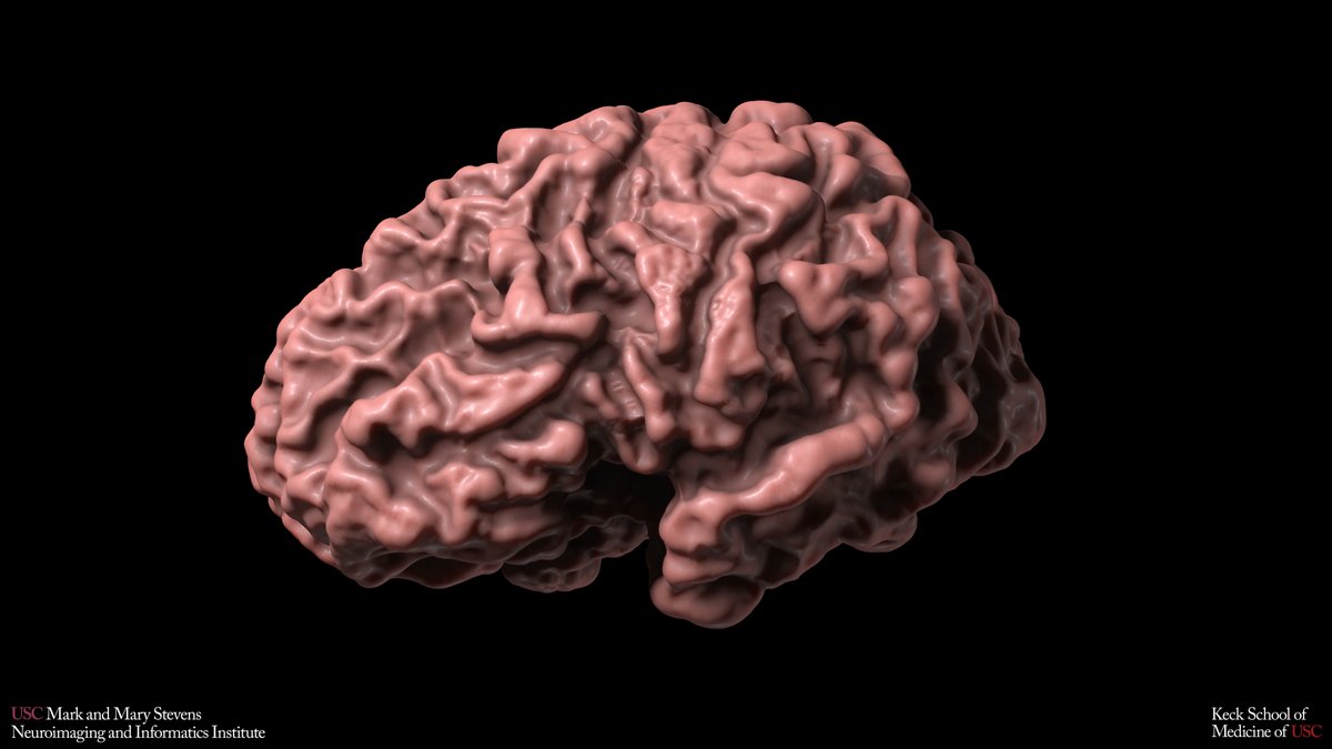 Lab of Neuro Imaging (@uscloni) on Twitter photo We're #hiring a #postdocposition! Research will focus on structural & microstructural modeling of brain tissue & brain clearance system. Learn more and APPLY: bit.ly/3Wyoocx
#neuroimaging #bioinformatics #bigdata We're #hiring a #postdocposition! Research will focus on structural & microstructural modeling of brain tissue & brain clearance system. Learn more and APPLY: bit.ly/3Wyoocx
#neuroimaging #bioinformatics #bigdata