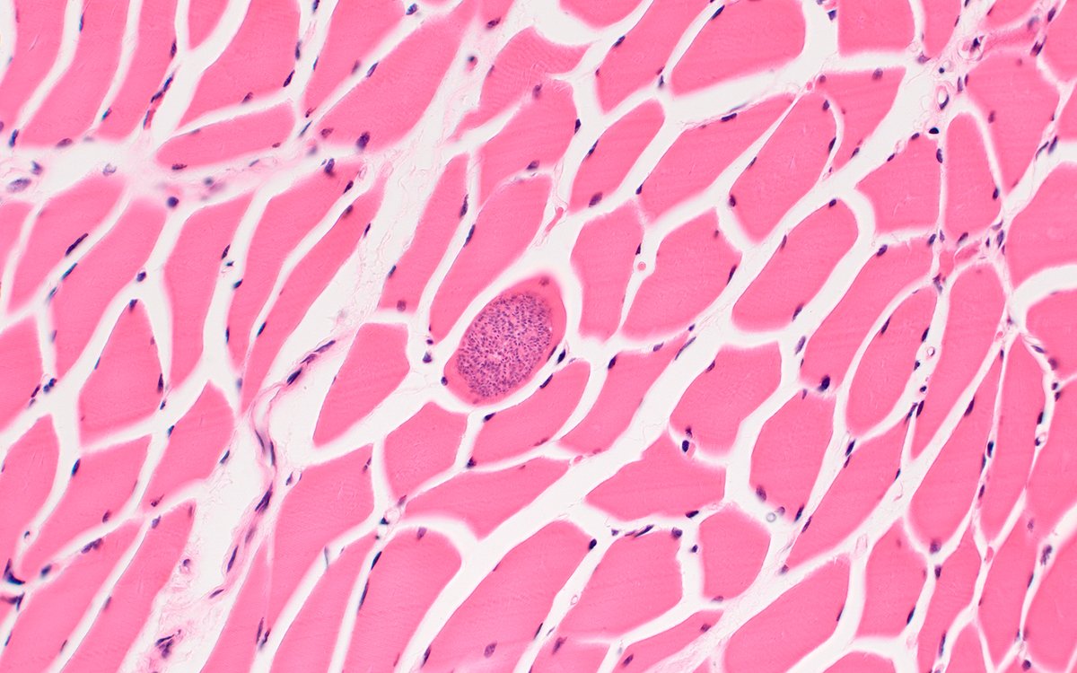 Bobbi Pritt, MD tweet media