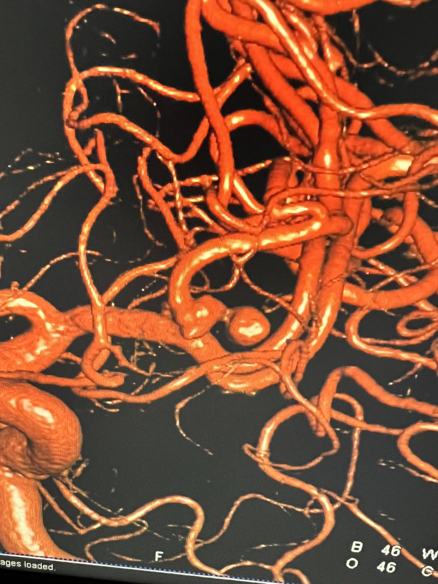 Alex Hoang tweet media