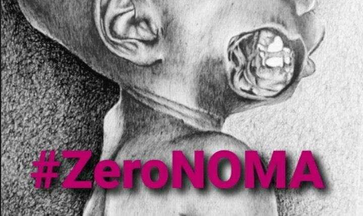 ZeronomaAfrica's tweet photo. Dear @GatesAfrica 

We work on #Noma and it's risk factors, a high mortality disease found amidst the world poorest people and tagged FACE OF POVERTY.

Since this people group is central to your work, we seek a working relationship with you to achieve #Zeronoma.

Thank you 🤝🤝 https://t.co/MrpzYA4DID