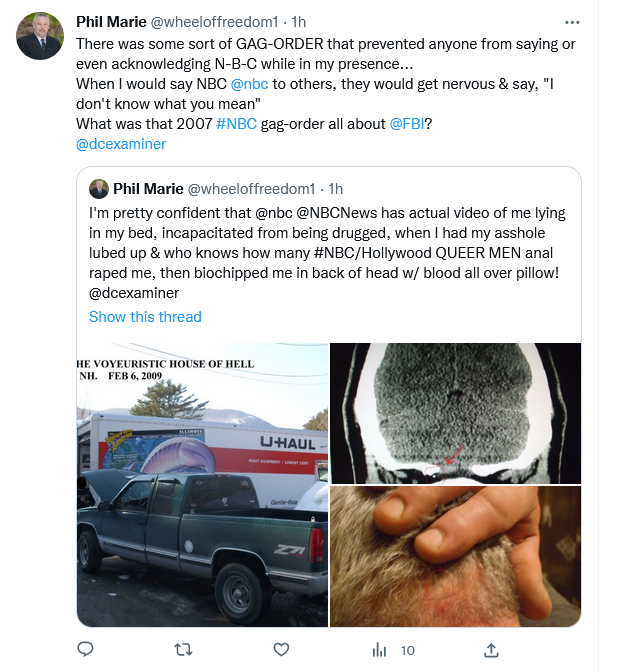 wheeloffreedom1's tweet photo. 1. @YNHH @ynhhealth You have UNDO what YOU DID to me... 
&amp; REMOVE THE GUT WOUND BIOCHIP!

2. #NBC @nbc @NBCNews @NBCNightlyNews You need to save YOUR ASS #RapeChip &amp; do a story on YALE biochipping #Americans w/out consent &amp; sharing data w/CCP.

3. @TheJusticeDept @FBI... HELP ME! https://t.co/uvtVQhQmBN