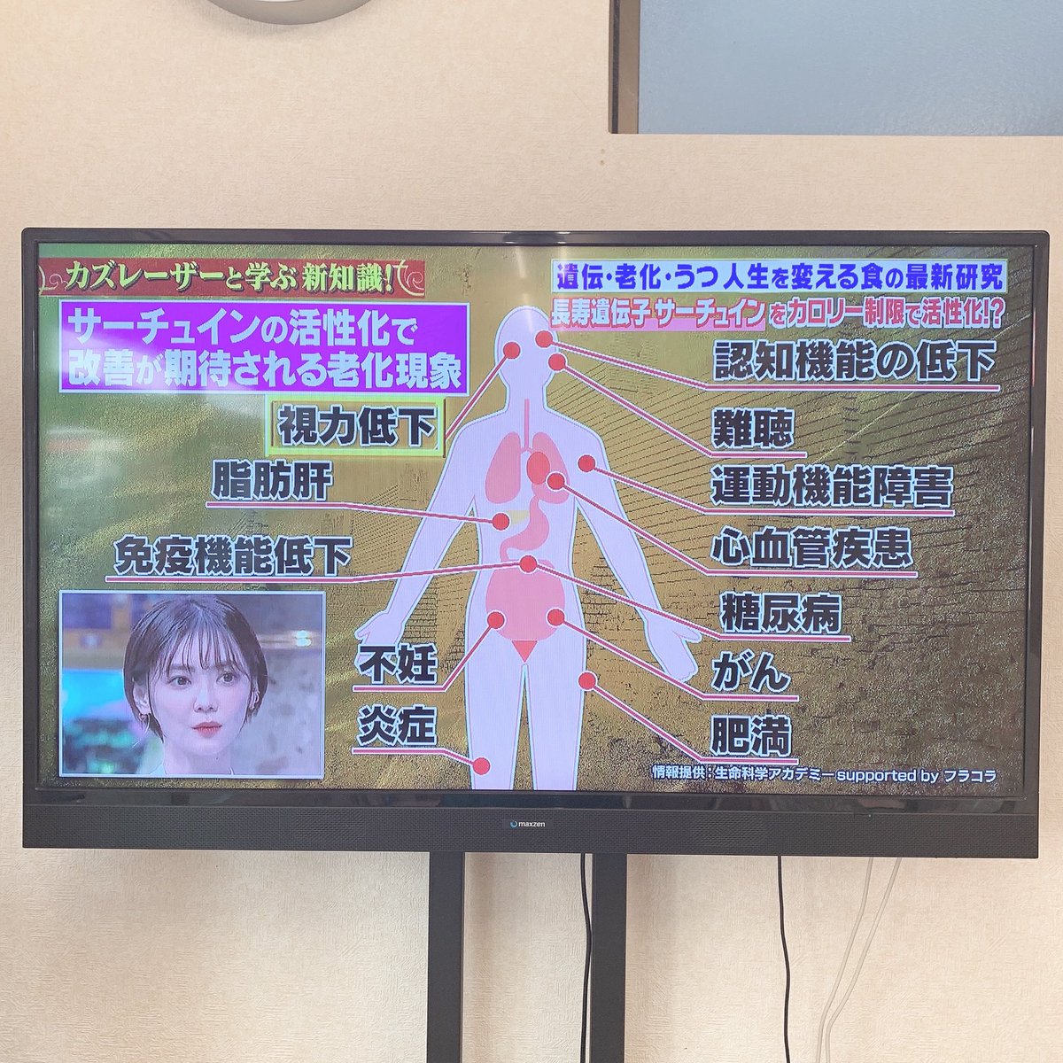 yotsuba_aoc's tweet photo. 老化を防いで若返りが出来る食材ご存知ですか⁉️

サーチュイン遺伝子を活性化させて老化阻止しましょう👍🏻

こちらの番組で詳しく見られますのでぜひ✨

https://t.co/Yl7UsZ2U7w

 #老化 #サーチュイン遺伝子 #若返り #ザクロ https://t.co/818faVpFMG