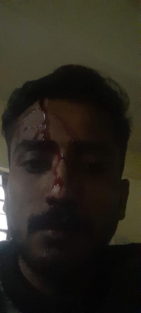 anil_aazad's tweet photo. #शर्मनाक 
जालोर जिले के सायला गाँव मे गुंडों ने भाई गौतम कुमार का अपहरण कर मारपीट की, @JalorePolice गिरफ्तारी तो दूर मुकदमा भी दर्ज नही करती है।
जालोर जिले मे इंद्र मेघवाल जैसा प्रकरण होने बाद भी पुलिस का ढूलमूल रवैया है, पुलिस की सह मे ही अपराधियों के हौसले बुलंद हो रहे है। https://t.co/dhnaIaKdUi