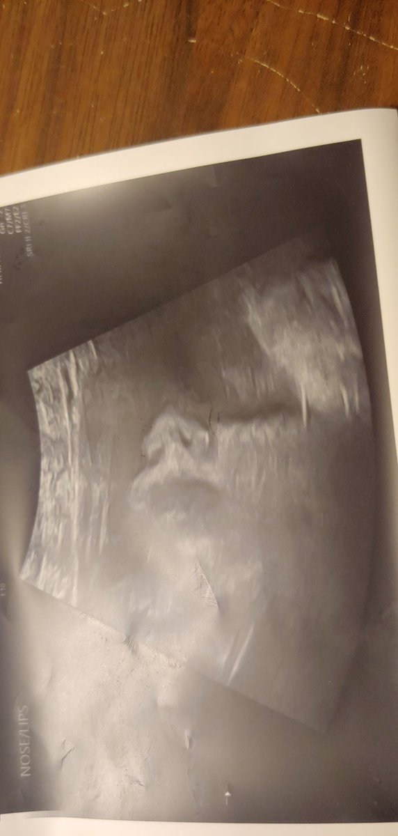 I am getting excited about our baby Amy coming but totally am a little anxious about leaving my work babies.  For 12 years I have wanted a baby with my hubby. I feel so blessed. Any love for her is appreciated! #wishlist #baby #newbaby #blessed #workingmom amazon.com/baby-reg/angel…