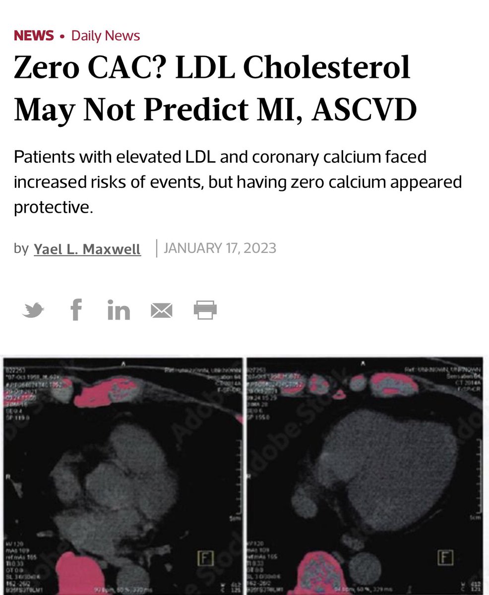 SBakerMD's tweet photo. New 2023 Study!! High LDL does NOT increase your risk for heart disease if you have a ZERO CAC score!! https://t.co/eKLORiKaND