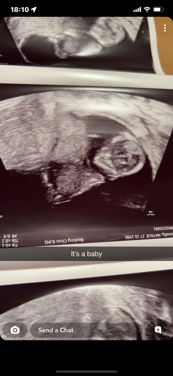 IrishBlue1878's tweet photo. 1 Month ago you, Dean &amp; our futures was cruelly taken away from us

1 Month on and we are still fighting and will continue to fight for you to get this monster and your justice

You haven’t left and will never leave our thoughts

I Love you Nats 💙💙

#JusticeForNatalieMcNally https://t.co/fsC4eoHH58