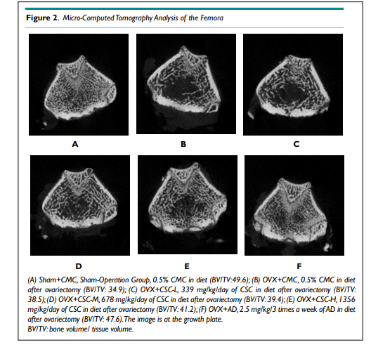 ORHOJ1's tweet photo. Effect of Compound Supplement on the Bone Health of Rats with Osteoporosis Induced ....by Wan-Li Chu, BSc

Read the full article here: https://t.co/36z2D9NXHW

For manuscript submission click here: https://t.co/aPIYLkWtKd

#openventio #OpenAccess #osteology #rheumatology https://t.co/dTDhEhAHAb