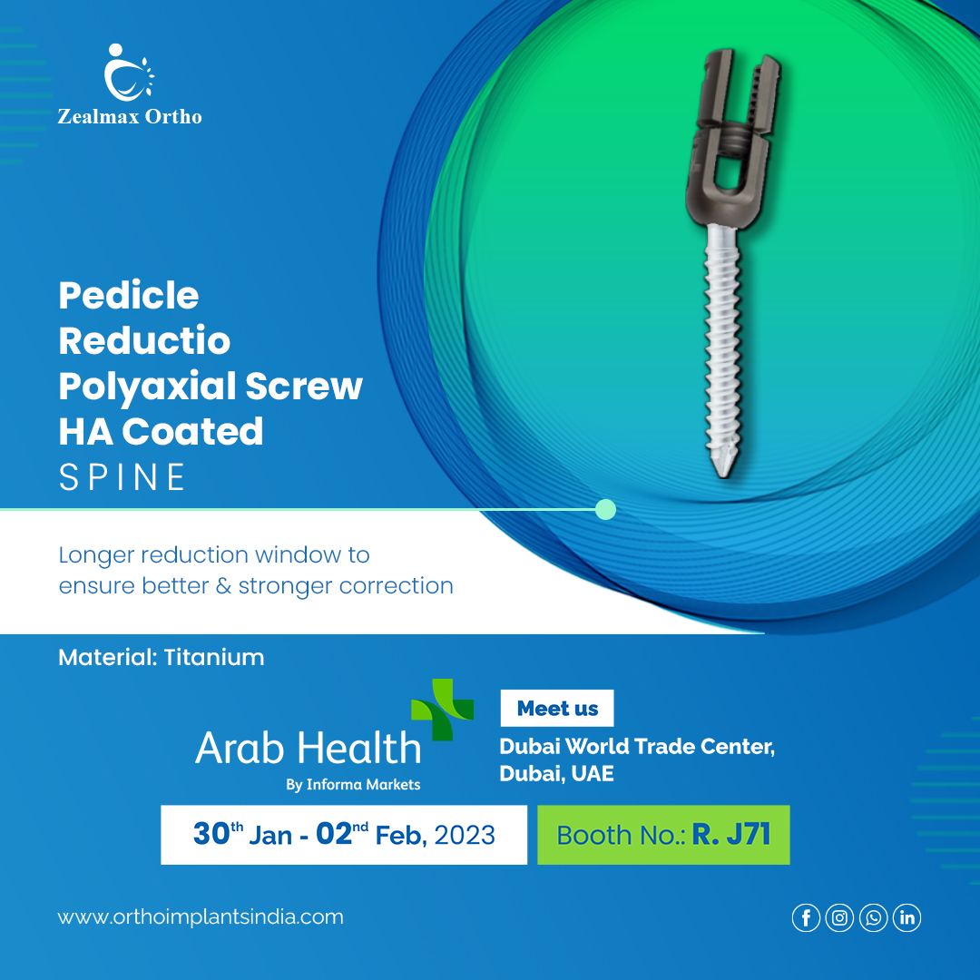 ZealmaxO's tweet photo. Pedicle Reduction Polyaxial Screw HA Coated is helpful if it is a vertical height malalignment from one screw head the next.#orthopedics #implants #implantsurgery #backingbones #orthodoctor #orthosurgeon #asia #africa #middleeast #ArabHealth2023 #ArabHealth #arabhealthexhibition https://t.co/TrpKzUZZcK