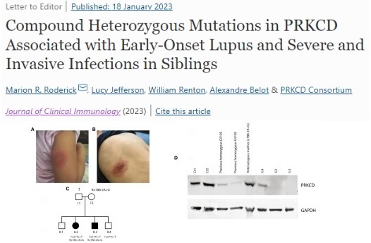 Primary_Immune's tweet photo. "Both patients had prominent features of autoimmunity &amp; immunodeficiency"
"the 1st published cases of disease due to compound hetero-z mutations in the PRKCD gene..."
https://t.co/IfdzvvvoYK #bioinformatics #rstats #openscience #snrtg #rheumatology #immunology #raredisease #upus https://t.co/cfM9n6FlmO