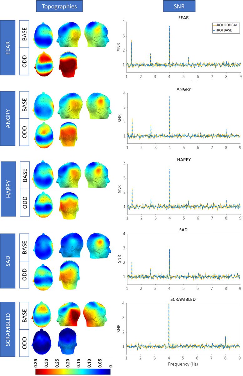 Center for Developmental Psychiatry (@cdp_kuleuven) on Twitter photo New paper out!
The Sound of Emotion: Pinpointing Emotional Voice Processing Via Frequency Tagging EEG
mdpi.com/2080278 #mdpibrainsci via <a href="/BrainSci_MDPI/">Brain Sciences MDPI</a>
Authors: Silke Vos, @CollignonOlivi1 and Bart Boets New paper out!
The Sound of Emotion: Pinpointing Emotional Voice Processing Via Frequency Tagging EEG
mdpi.com/2080278 #mdpibrainsci via <a href="/BrainSci_MDPI/">Brain Sciences MDPI</a>
Authors: Silke Vos, @CollignonOlivi1 and Bart Boets