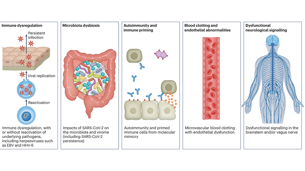 NaturePortfolio's tweet photo. A Review in @NatureRevMicro explores our knowledge of long COVID and highlights key findings, including potential mechanisms, the overlap with other conditions and potential treatments. https://t.co/hpV1HhiFRm https://t.co/fGsT1MBkBn