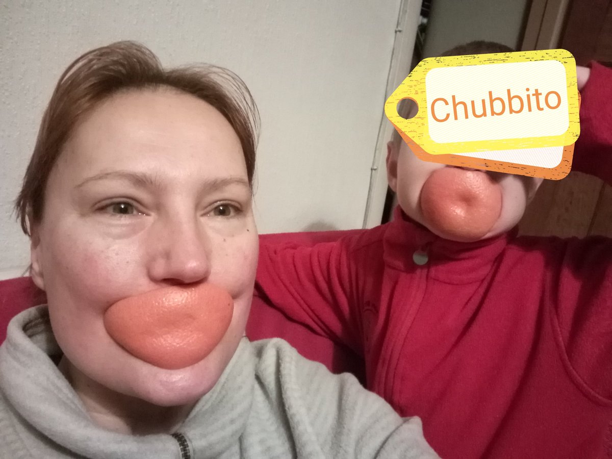 Lutoslava's tweet photo. Grapefruit smiles ππ
#grapefruit #grapefruitpeel #Chubbito #MrsChubb #Lutoslava https://t.co/4U3yvs0XV3