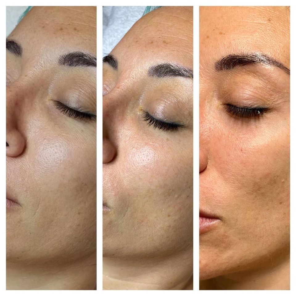 Fanofstyle's tweet photo. Nuevo post en Fan of Style "Los tratamientos de belleza que triunfarán en 2023" https://t.co/BWK2SwcjBy #efectolifting #protocolosfaciales #manchas #belleza #rejuvenecimientofacial #cuidadosdelapiel #cuello #pielesdañadas #tratamientosestéticos #celulitis https://t.co/zTUxFHwCfQ