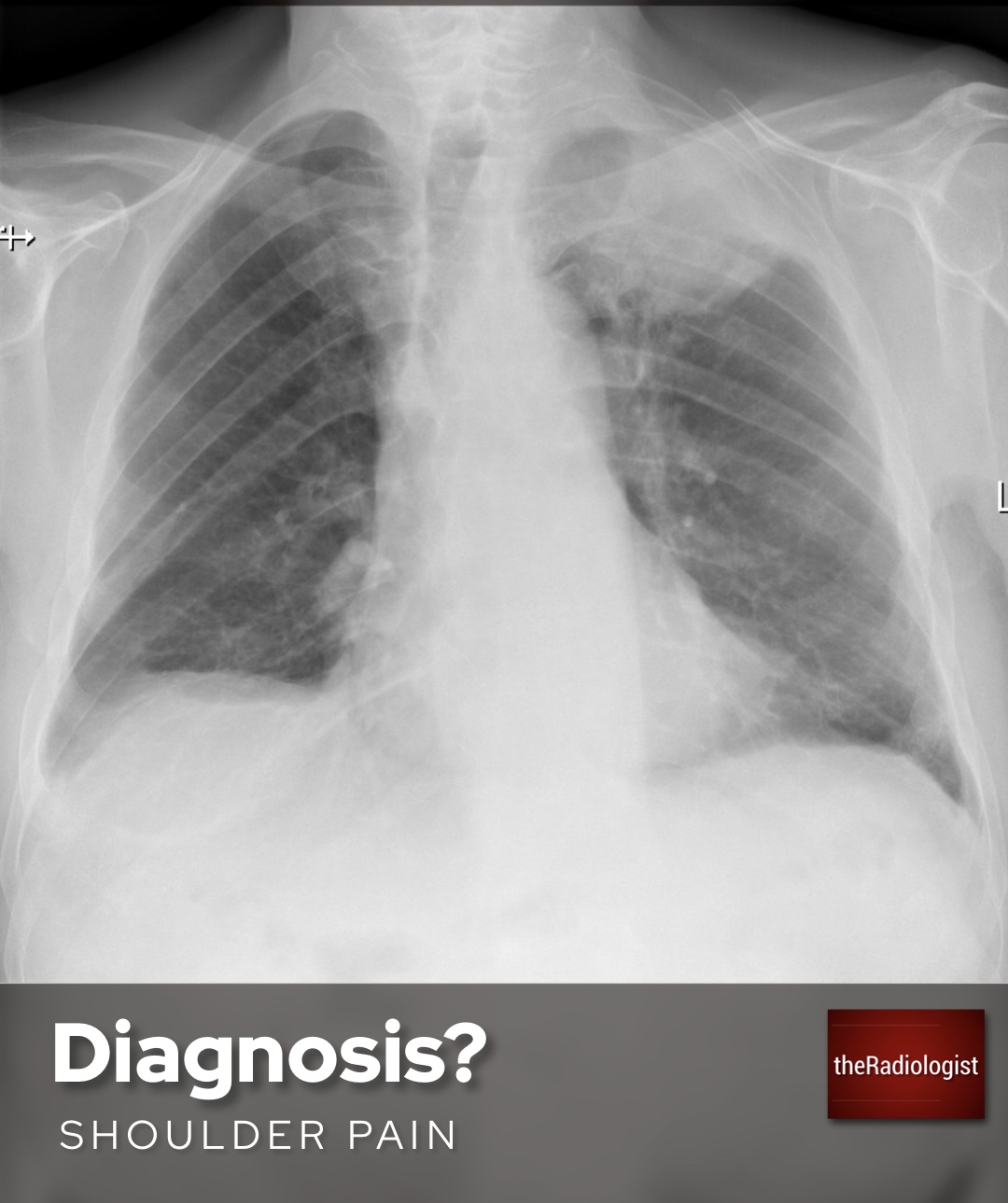 theRadiologist on Twitter "Male in his 60s presents to his GP with