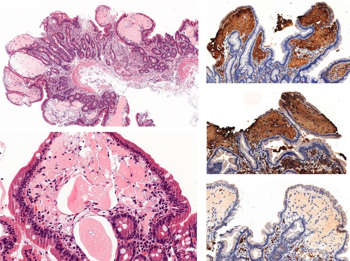 Gut Journal tweet media
