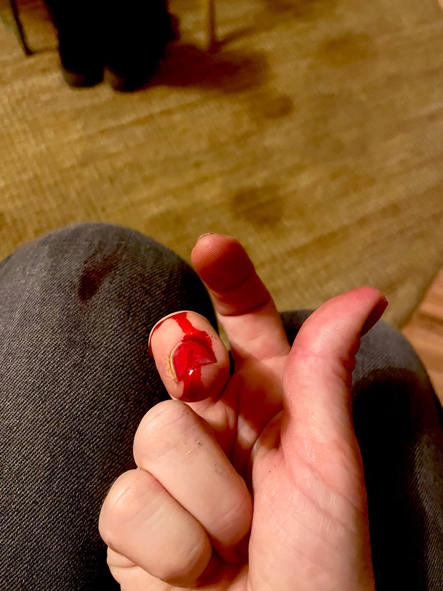 deraletta1's tweet photo. Snijden aan je fucking i-pad? Kan ik!
Terwijl je sta te koken, ondertussen je kind veels te vroeg moet halen en nog duizend dingen wilde doen. Ok. Ok. Got this too
#Chaoot https://t.co/h2xSfzLYKz