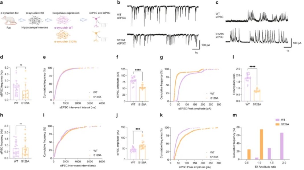 ScienceofPD's tweet photo. Researchers report a site-specific, reversible phosphorylation of the #Parkinsons-associated protein α-synuclein at Serine129 which occurs physiologically during neuronal activity; "Adds nuance to the interpretation of pS129 as a synucleinopathy biomarker"
https://t.co/uwDrH44qNv https://t.co/WThRvaeyo6