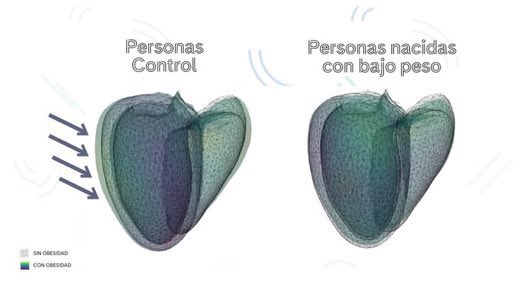 Alvaro Sepulveda Martinez, PhD (@alvaro_sep_m) on Twitter photo Nuestro más reciente estudio publicado en @esc_journals ha demostrado que la obesidad induce un impacto negativo en la morfología cardiaca en adultos nacidos con restricción de crecimiento fetal. Un gran resultado liderado por <a href="/FatimaCrispi/">Fatima Crispi</a> y <a href="/BCNatalResearch/">BCNatal Fetal Medicine Research</a>. Nuestro más reciente estudio publicado en @esc_journals ha demostrado que la obesidad induce un impacto negativo en la morfología cardiaca en adultos nacidos con restricción de crecimiento fetal. Un gran resultado liderado por <a href="/FatimaCrispi/">Fatima Crispi</a> y <a href="/BCNatalResearch/">BCNatal Fetal Medicine Research</a>.